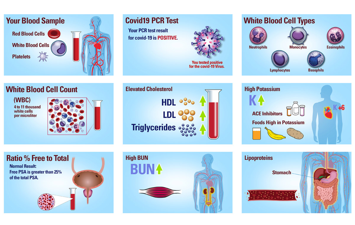 Medical Illustrations for animated lab results APP (Client: LabRev)